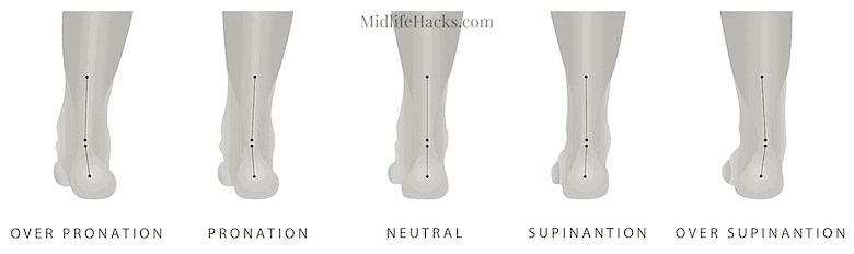 pronation diagram - over normal under (supination)